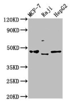 Invitrogen SERPINA11 Polyclonal Antibody 100 &mu;g; Unconjugated:Antibodies,