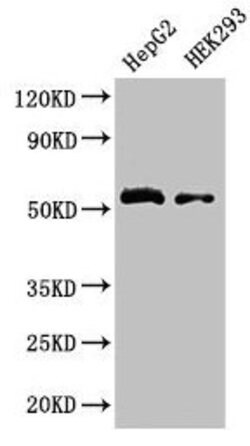 Invitrogen LDHD Polyclonal Antibody 100 &mu;g; Unconjugated:Antibodies,