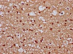 Invitrogen TIPARP Polyclonal Antibody 100 &mu;g; Unconjugated:Antibodies,