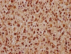 Invitrogen TIPARP Polyclonal Antibody 100 &mu;g; Unconjugated:Antibodies,