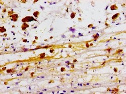 Invitrogen ZBTB46 Polyclonal Antibody 100 &mu;g; Unconjugated:Antibodies,
