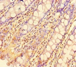 Invitrogen ZBTB46 Polyclonal Antibody 100 &mu;g; Unconjugated:Antibodies,