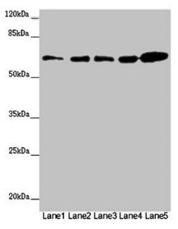 Invitrogen ZBTB46 Polyclonal Antibody 100 &mu;g; Unconjugated:Antibodies,