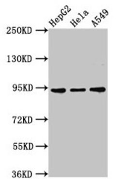 Invitrogen CHD1L Polyclonal Antibody 100 &mu;g | Buy Online | Invitrogen&trade; | Fisher Scientific