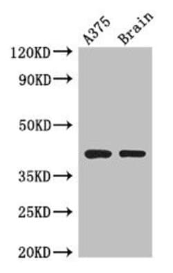 Invitrogen SEPT12 Polyclonal Antibody 100 &mu;g; Unconjugated:Antibodies,