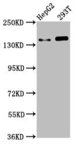 Invitrogen SMC5 Polyclonal Antibody 100 &mu;g; Unconjugated:Antibodies,