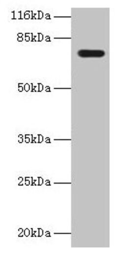 Invitrogen KBTBD2 Polyclonal Antibody 100 &mu;g; Unconjugated:Antibodies,
