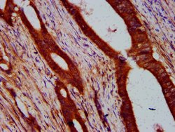Invitrogen ULK2 Polyclonal Antibody 100 &mu;g; Unconjugated:Antibodies,