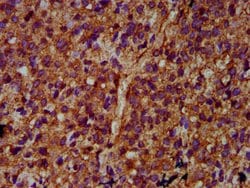 Invitrogen ULK2 Polyclonal Antibody 100 &mu;g; Unconjugated:Antibodies,