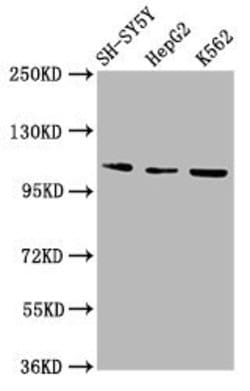 Invitrogen ULK2 Polyclonal Antibody 100 &mu;g; Unconjugated:Antibodies,