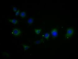 MMD2 Polyclonal Antibody:Antibodies, Polyclonal