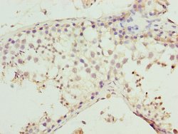 MMD2 Polyclonal Antibody:Antibodies, Polyclonal
