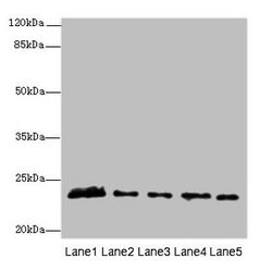 MMD2 Polyclonal Antibody:Antibodies, Polyclonal