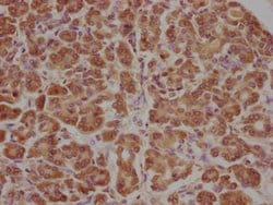 Invitrogen APCDD1 Polyclonal Antibody 100 &mu;L | Buy Online | Invitrogen&trade; | Fisher Scientific