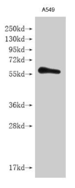 Invitrogen IFNLR1 Polyclonal Antibody 100 &mu;L; Unconjugated:Antibodies,