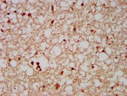 DMP4 Polyclonal Antibody:Antibodies, Polyclonal