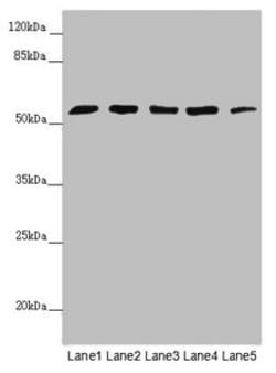 Invitrogen CEP57L1 Polyclonal Antibody 100 &mu;L; Unconjugated:Antibodies,