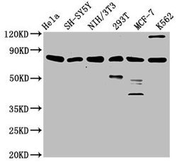 Invitrogen KMT2E Polyclonal Antibody 100 &mu;L; Unconjugated:Antibodies,