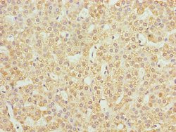 Invitrogen JAGN1 Polyclonal Antibody 100 &mu;g; Unconjugated:Antibodies,