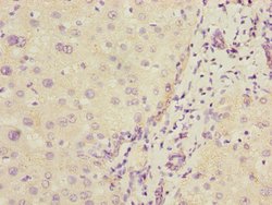 Invitrogen COMMD1 Polyclonal Antibody 100 &mu;L; Unconjugated:Antibodies,