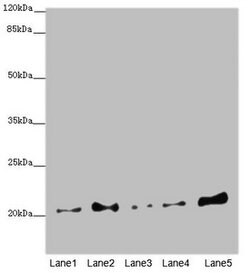 Invitrogen COMMD1 Polyclonal Antibody 100 &mu;L; Unconjugated:Antibodies,