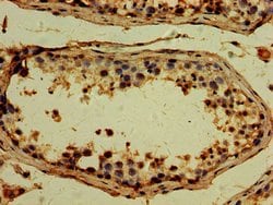 Invitrogen TTLL6 Polyclonal Antibody 100 &mu;g; Unconjugated:Antibodies,