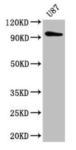 Invitrogen TTLL6 Polyclonal Antibody 100 &mu;g; Unconjugated:Antibodies,