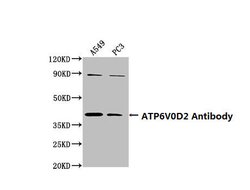 Invitrogen ATP6V0D2 Polyclonal Antibody 100 &mu;L; Unconjugated:Antibodies,