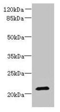 Invitrogen DYDC1 Polyclonal Antibody 100 &mu;g; Unconjugated:Antibodies,