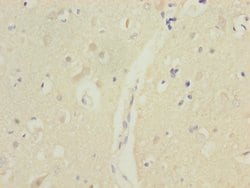 MTERFD1 Polyclonal Antibody:Antibodies, Polyclonal