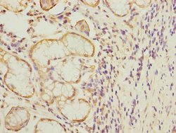 MTERFD1 Polyclonal Antibody:Antibodies, Polyclonal