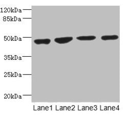 MTERFD1 Polyclonal Antibody:Antibodies, Polyclonal