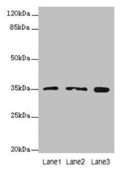 Invitrogen FAHD2A Polyclonal Antibody 100 &mu;g; Unconjugated:Antibodies,