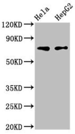 Invitrogen FRMD6 Polyclonal Antibody 100 &mu;L | Buy Online | Invitrogen&trade; | Fisher Scientific