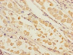 Pirh2 Polyclonal Antibody:Antibodies, Polyclonal