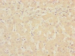 Pirh2 Polyclonal Antibody:Antibodies, Polyclonal