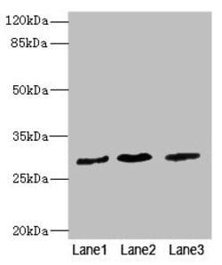 Pirh2 Polyclonal Antibody:Antibodies, Polyclonal
