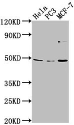 Invitrogen TMEM237 Polyclonal Antibody 100 &mu;L; Unconjugated:Antibodies,