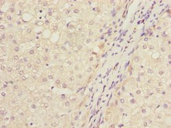 IWS1 Polyclonal Antibody:Antibodies, Polyclonal