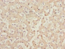 IWS1 Polyclonal Antibody:Antibodies, Polyclonal
