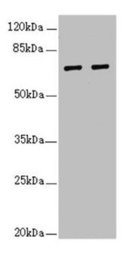 IWS1 Polyclonal Antibody:Antibodies, Polyclonal
