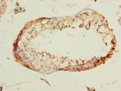 Invitrogen DBF4B Polyclonal Antibody 100 &mu;g; Unconjugated:Antibodies,