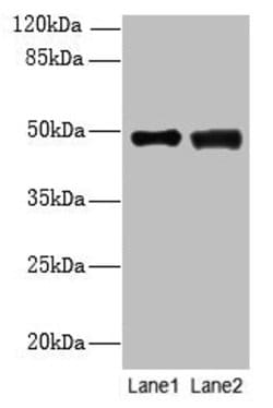 Invitrogen DBF4B Polyclonal Antibody 100 &mu;g; Unconjugated:Antibodies,