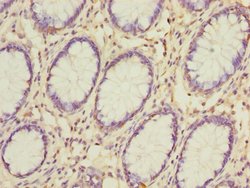 Invitrogen GSDMB Polyclonal Antibody 100 &mu;g; Unconjugated:Antibodies,