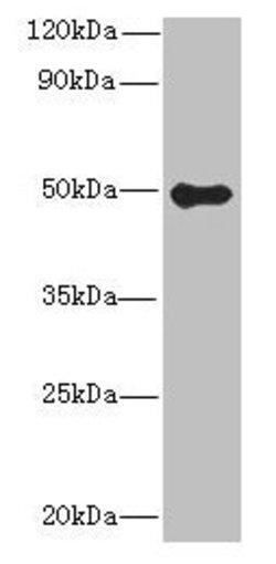 Invitrogen GSDMB Polyclonal Antibody 100 &mu;g; Unconjugated:Antibodies,