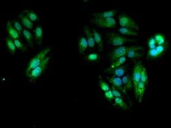 Invitrogen TBC1D15 Polyclonal Antibody 100 &mu;g; Unconjugated:Antibodies,