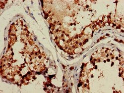 Invitrogen TBC1D15 Polyclonal Antibody 100 &mu;g; Unconjugated:Antibodies,
