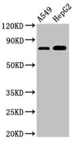 Invitrogen TBC1D15 Polyclonal Antibody 100 &mu;g; Unconjugated:Antibodies,