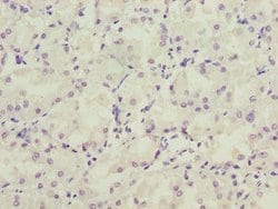 Invitrogen LRRC20 Polyclonal Antibody 100 &mu;g; Unconjugated:Antibodies,