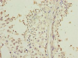Invitrogen LRRC20 Polyclonal Antibody 100 &mu;g; Unconjugated:Antibodies,